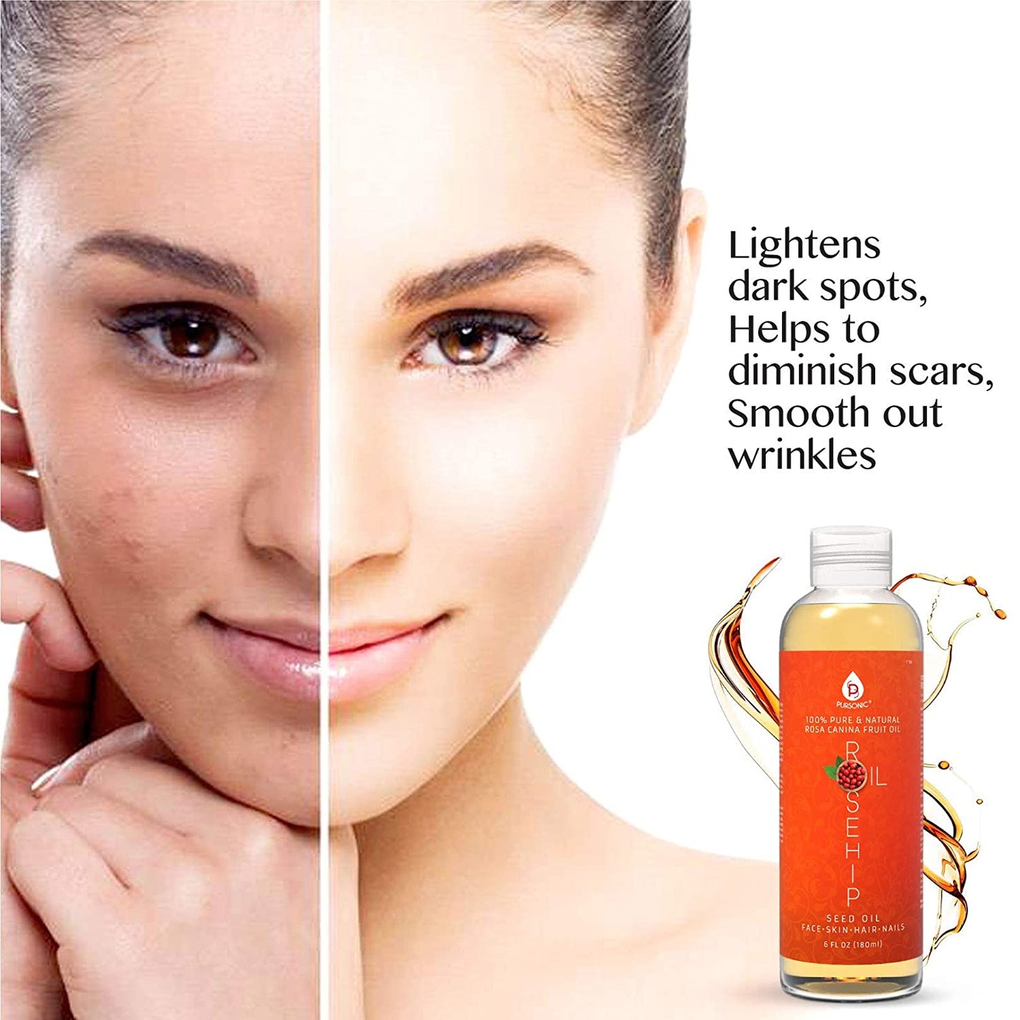 100% Pure & Natural Cold Pressed Premium Rosehip Seed Oil 6 Oz - Health & Longevity Life