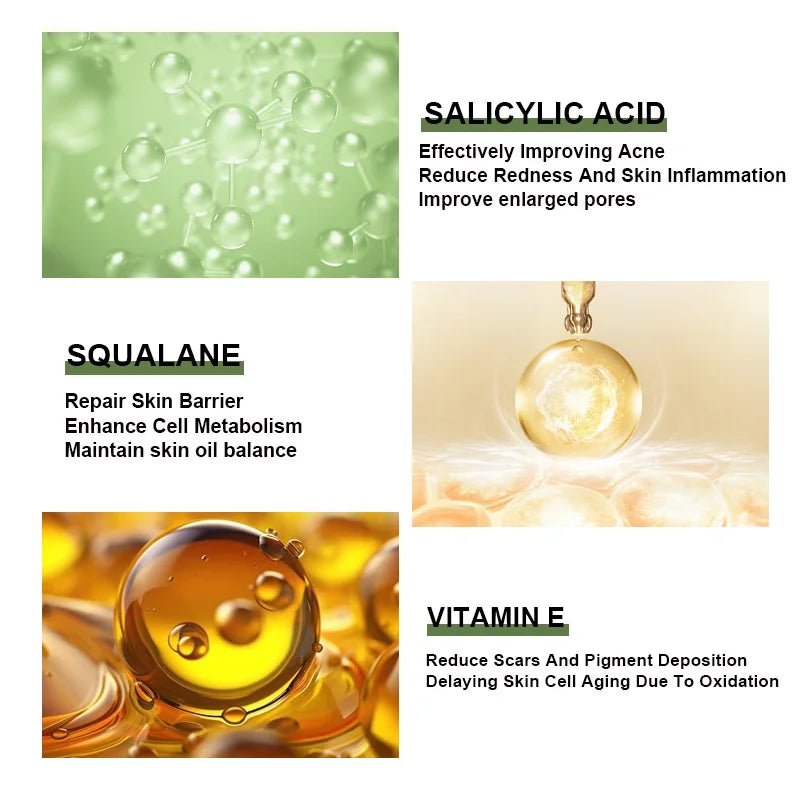 Anti - Acne Face Serum Salicylic Acid Acne Removing Essence Squalane Vitamin E Moisturizing Brightening Korean Skincare Products - Health & Longevity Life