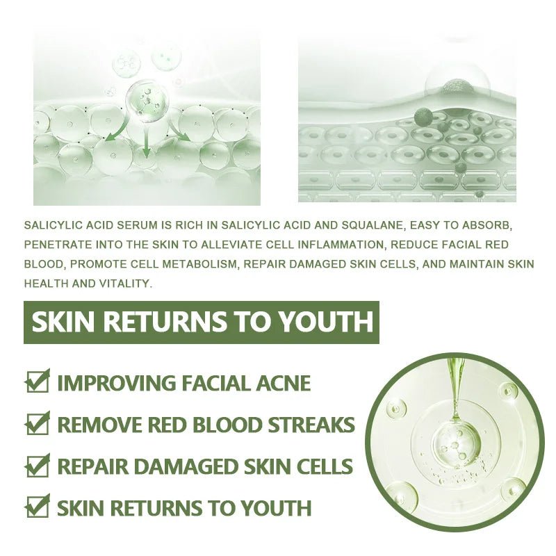 Anti - Acne Face Serum Salicylic Acid Acne Removing Essence Squalane Vitamin E Moisturizing Brightening Korean Skincare Products - Health & Longevity Life