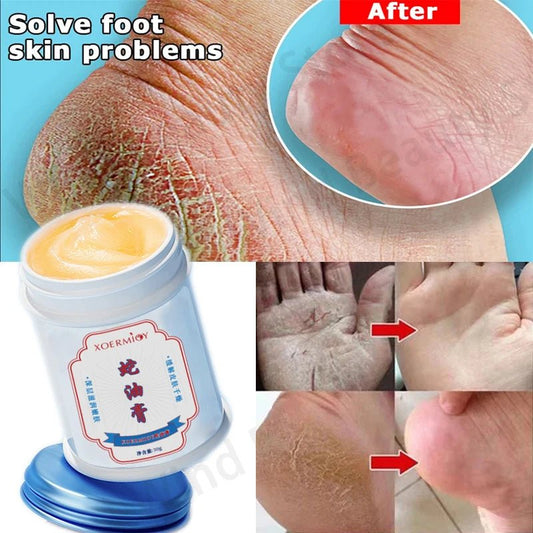 Herbal Anti Crack Foot Cream Heel Cracking Repair Products Exfoliation Dead Skin Removal Softening Moisturize Smooth Skin Care - Health & Longevity Life