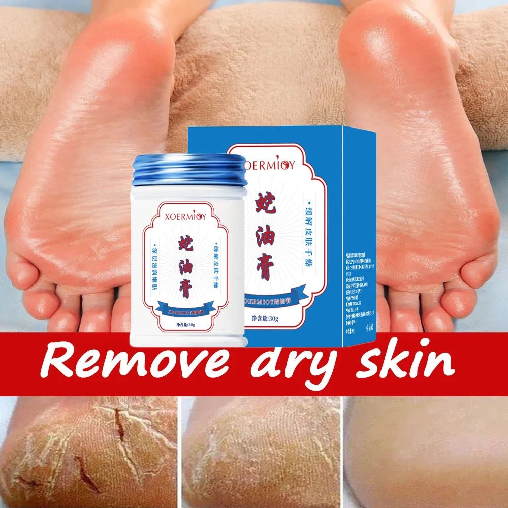 Herbal Anti Crack Foot Cream Heel Cracking Repair Products Exfoliation Dead Skin Removal Softening Moisturize Smooth Skin Care - Health & Longevity Life